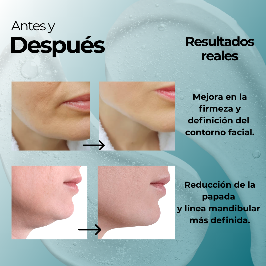 Reductor de papada reutilizable para mujer y hombre.